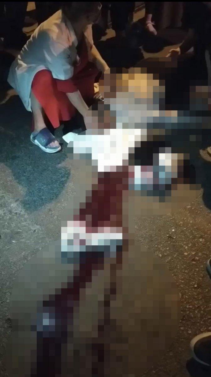 Esenyurt’ta çöp atmaya çıkan genç kıza otomobil çarptı