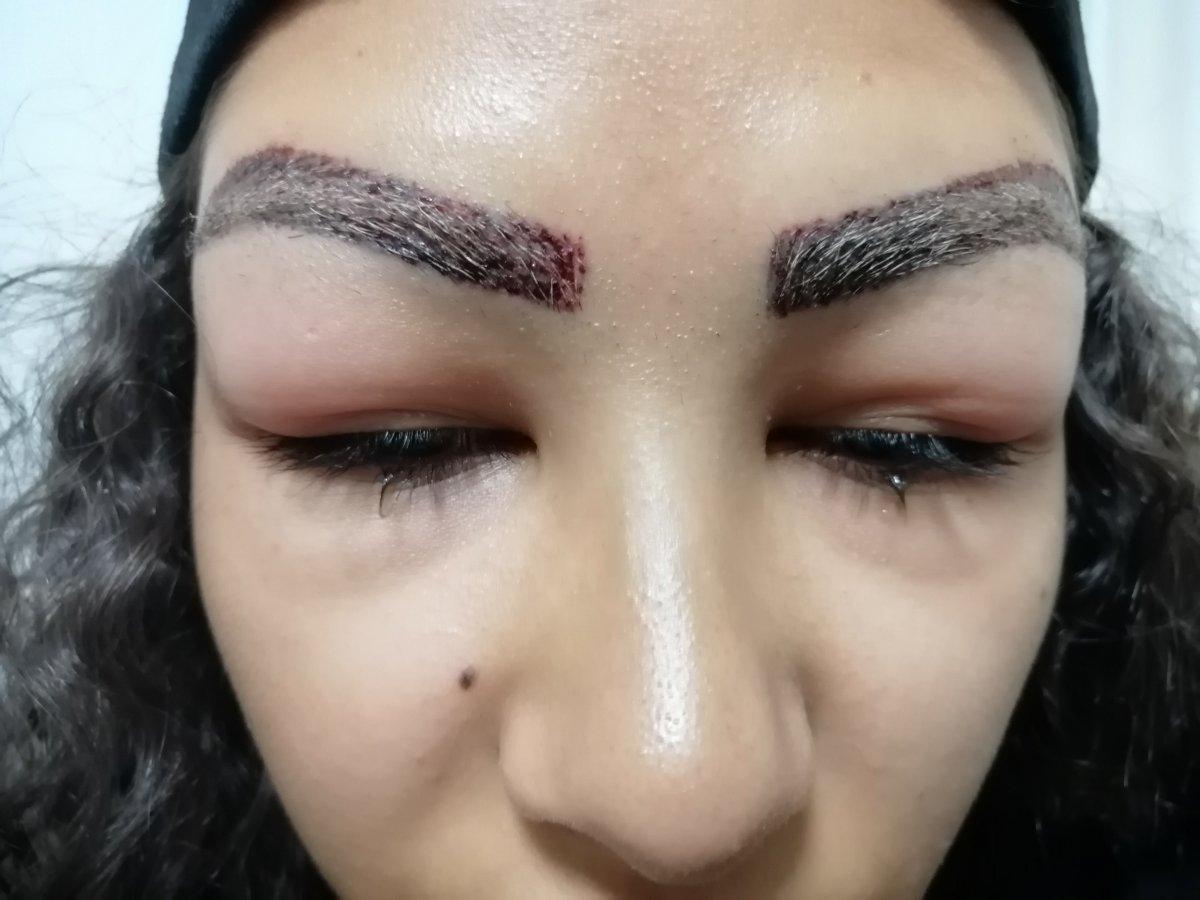 Aksaray'da reklam yüzü olmaya gitti, hastanelik oldu