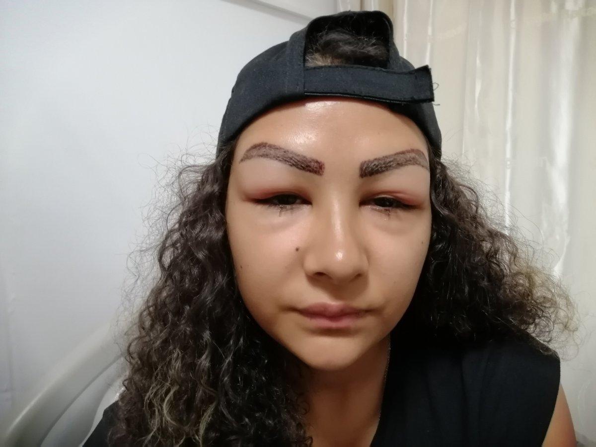 Aksaray'da reklam yüzü olmaya gitti, hastanelik oldu