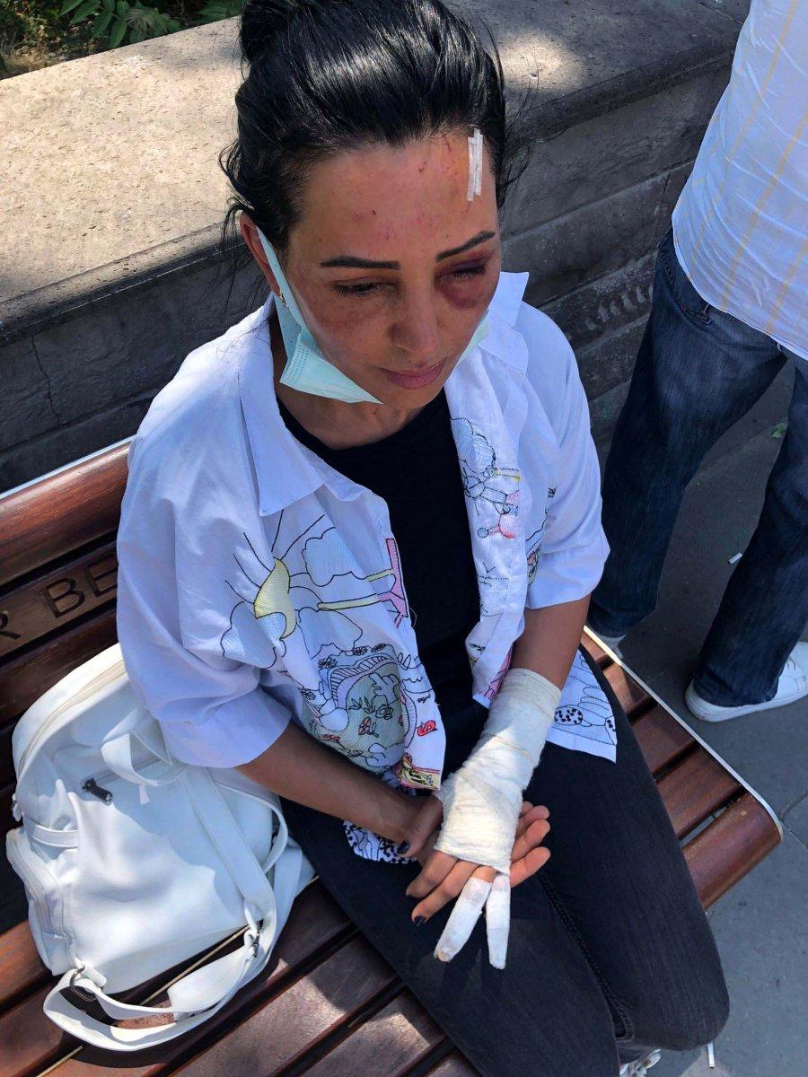 Ankara'da eski sevgilisi tarafından darbedildi
