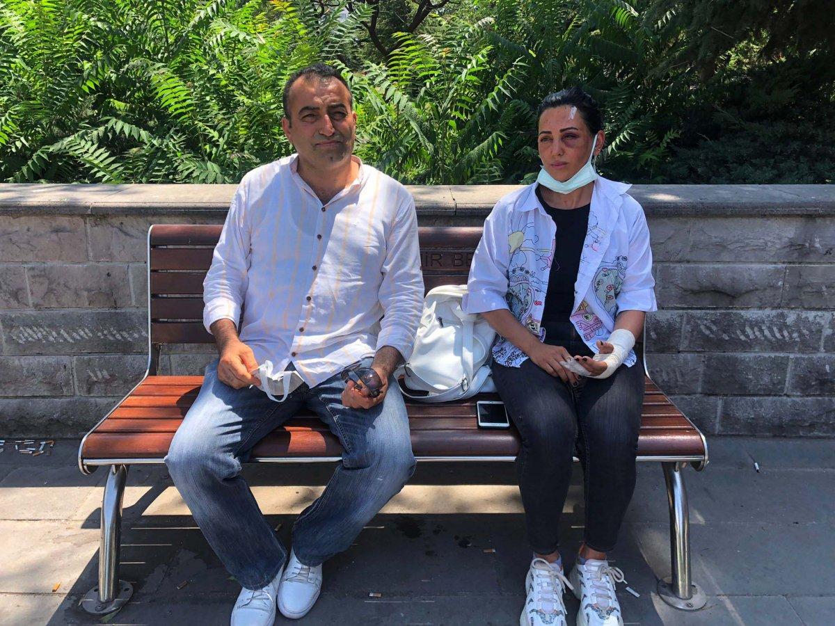 Ankara'da eski sevgilisi tarafından darbedildi