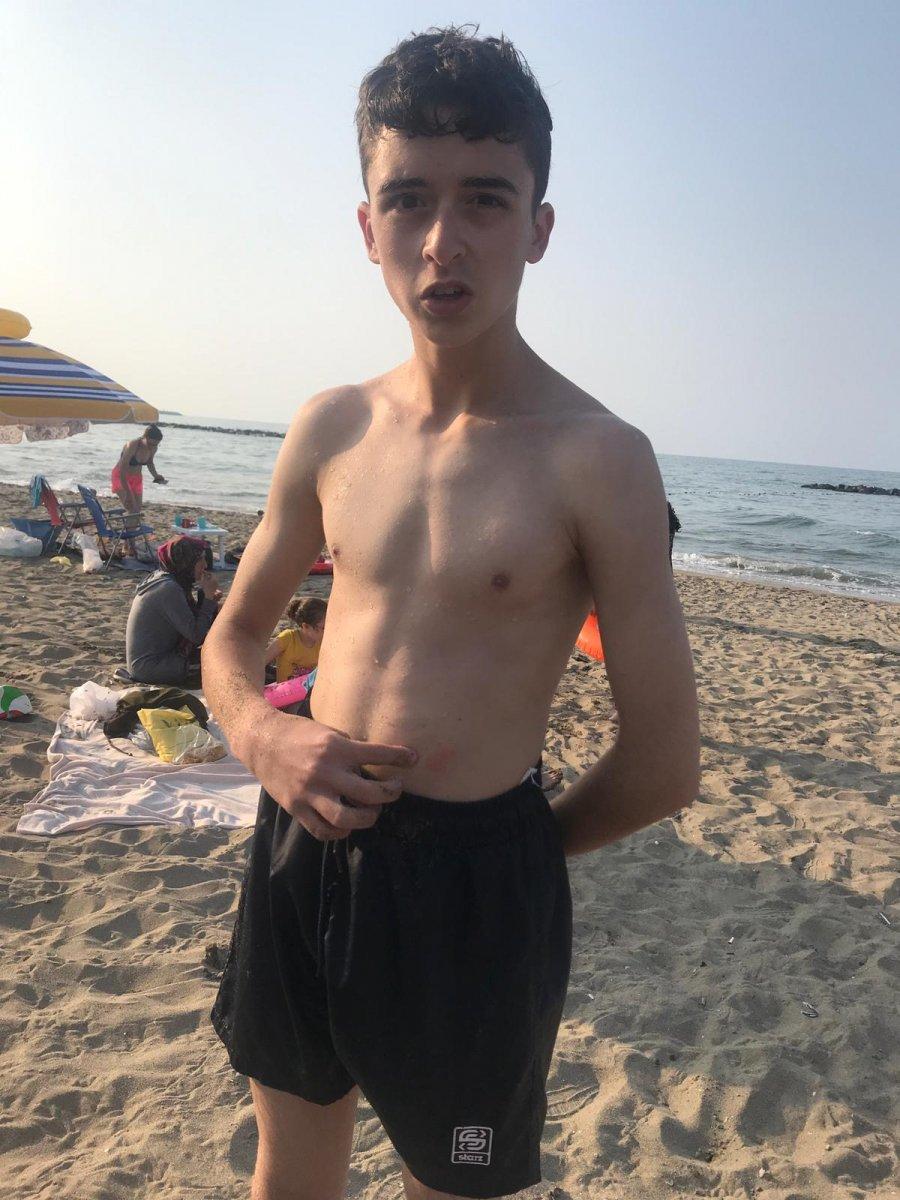 Sakarya'da denize giren 32 kişinin vücudunda kızarıklıklar oluştu