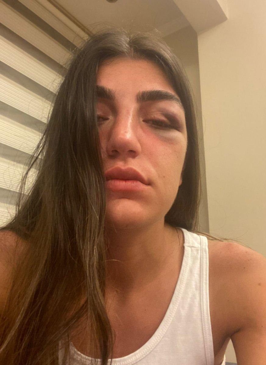 Manken Gizem Akbaş'ı öldüresiye döven eski sevgilisi tutuklandı