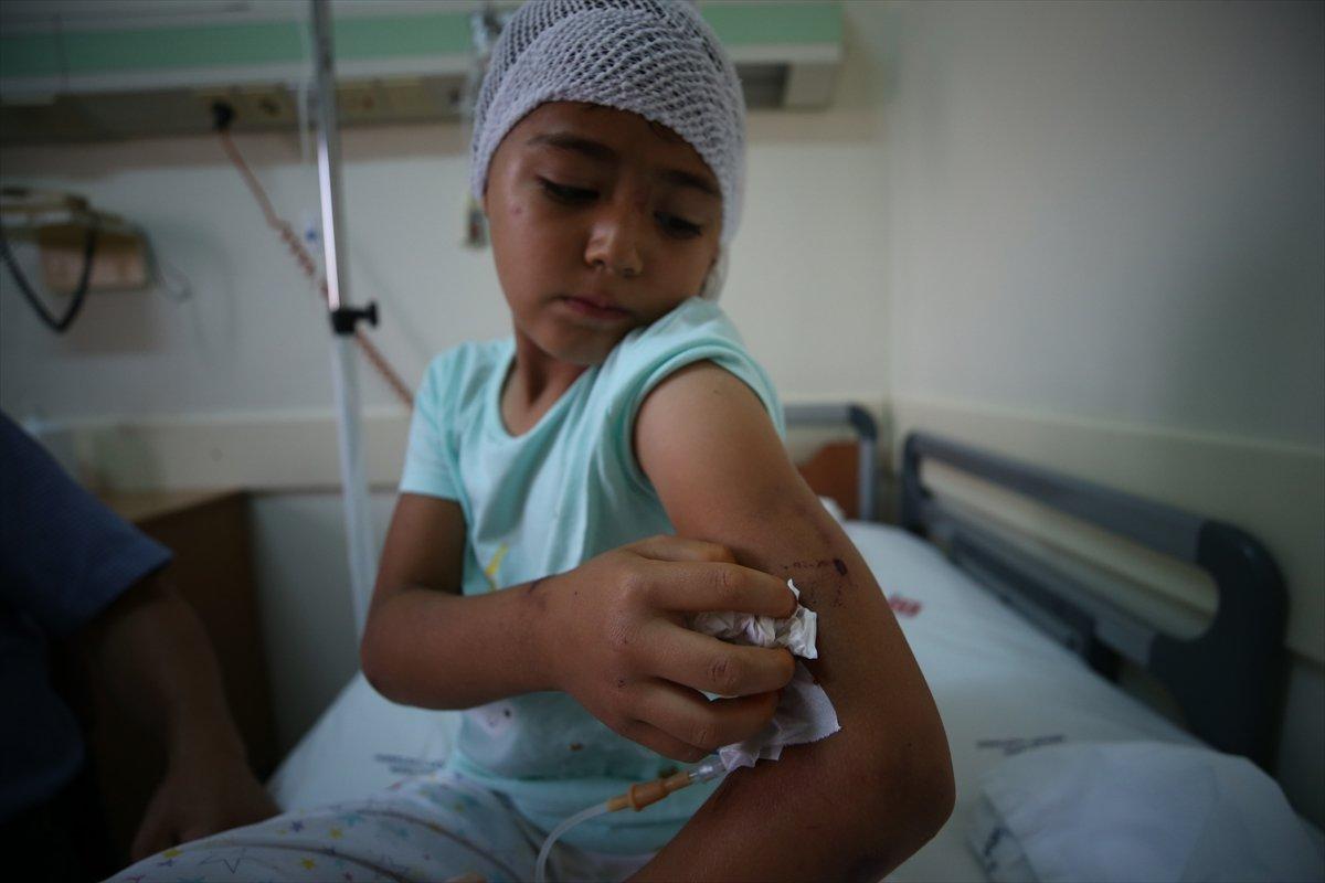 Balıkesir'de 8 yaşındaki kız, pitbull saldırısına uğradı