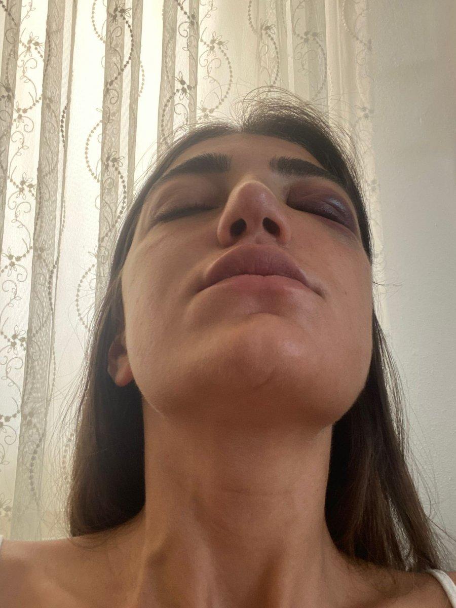 Manken Gizem Akbaş'ı öldüresiye döven eski sevgilisi tutuklandı