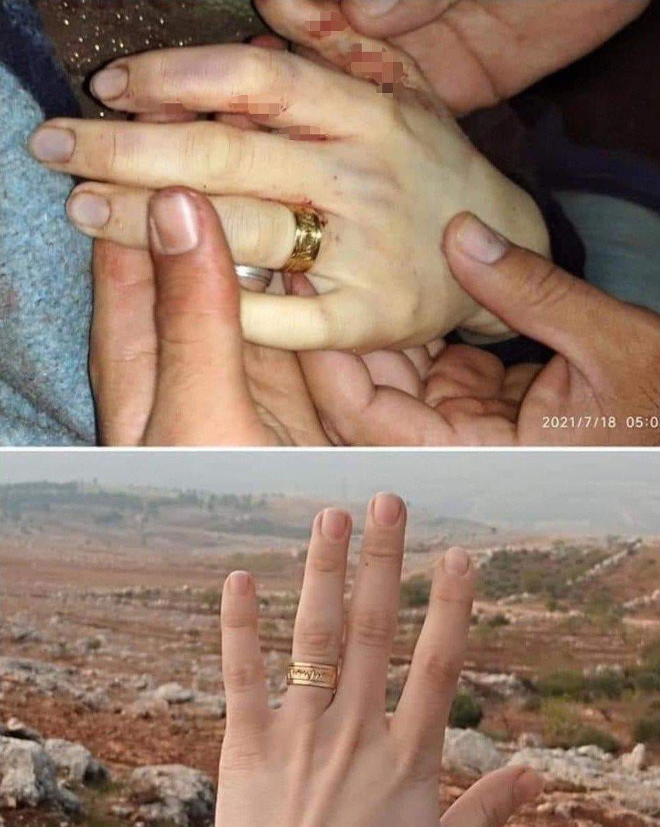 Suriye’de genç kız, düğününden 6 gün sonraki saldırılarda öldü