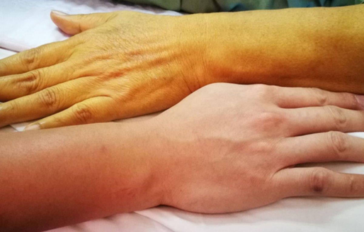 Sessiz ilerleyen 10 ölümcül hastalık