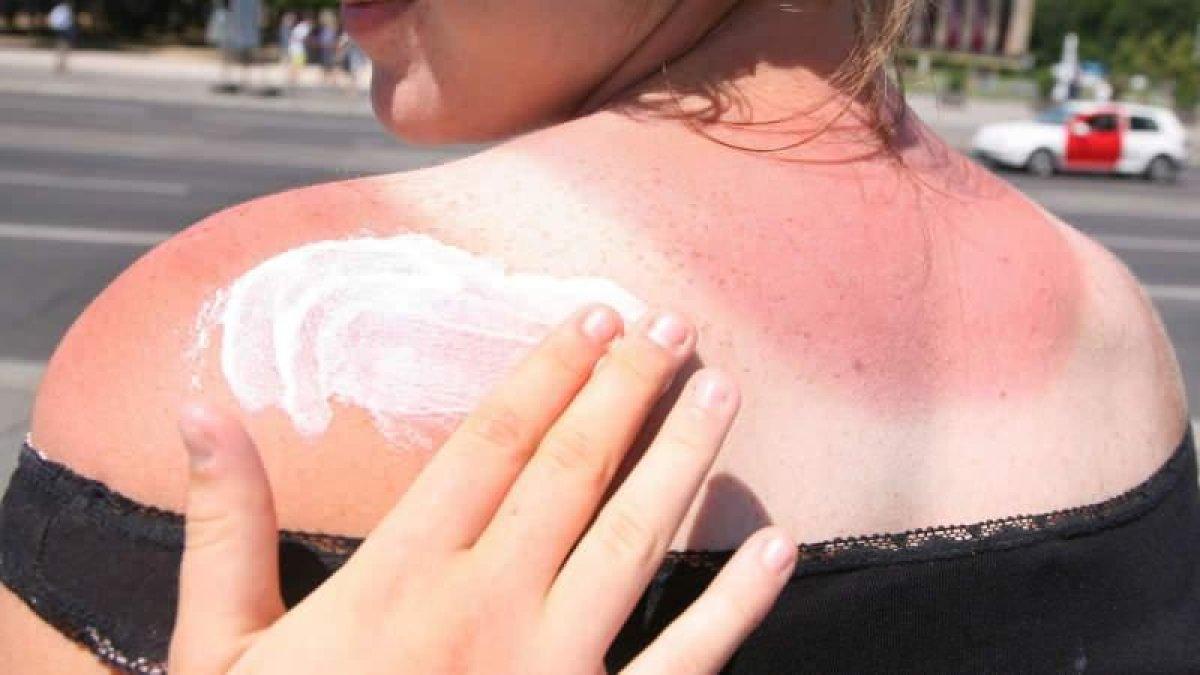 Bikini ve mayo izlerine kolayca veda edin