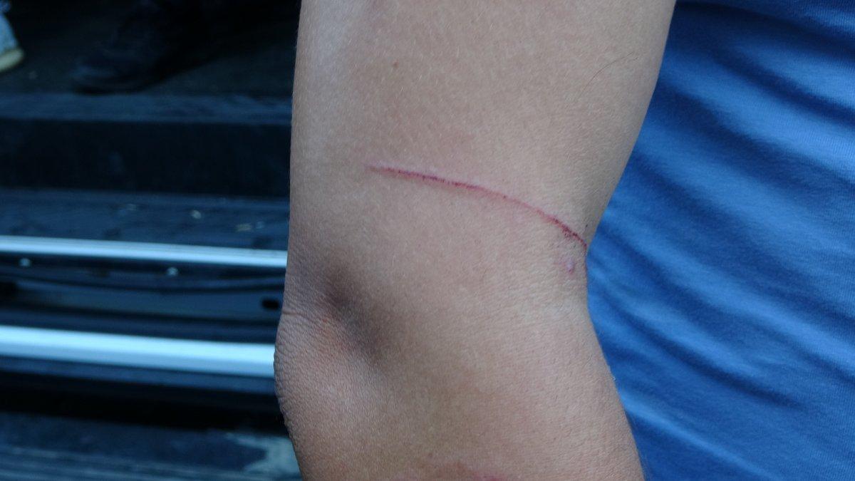 Gezi Parkı’nda zabıta ile seyyar satıcılar arasında taşlı, sopalı kavga