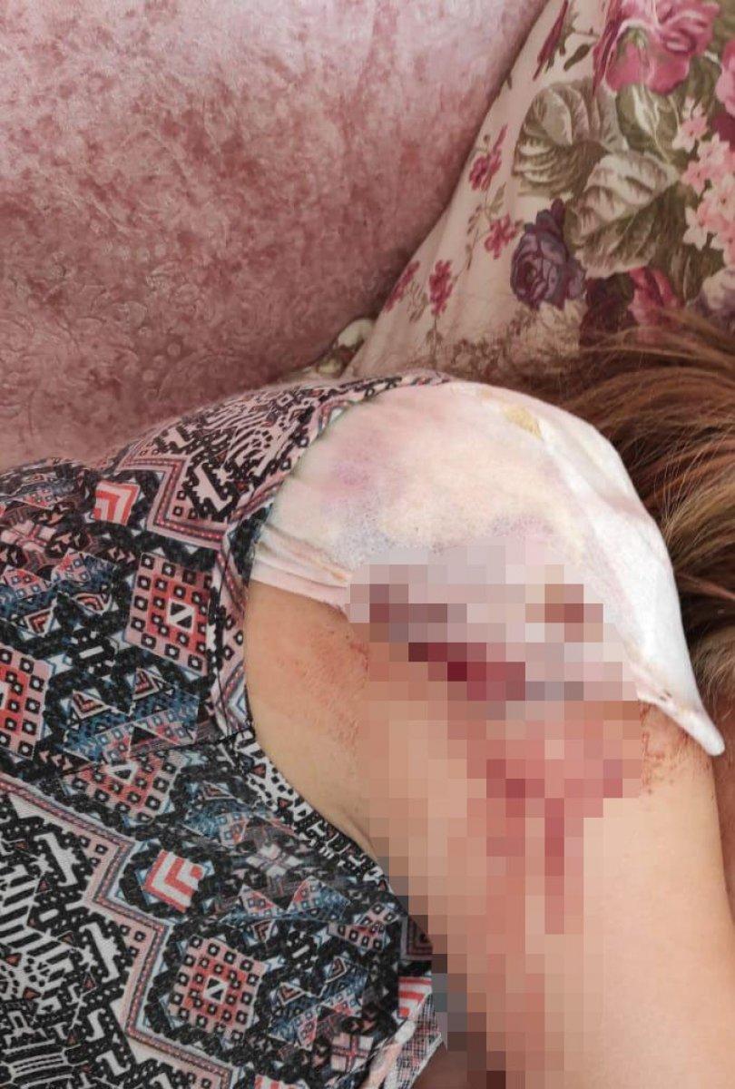 Nevşehir’de anne ve kızına tarlada köpek saldırdı