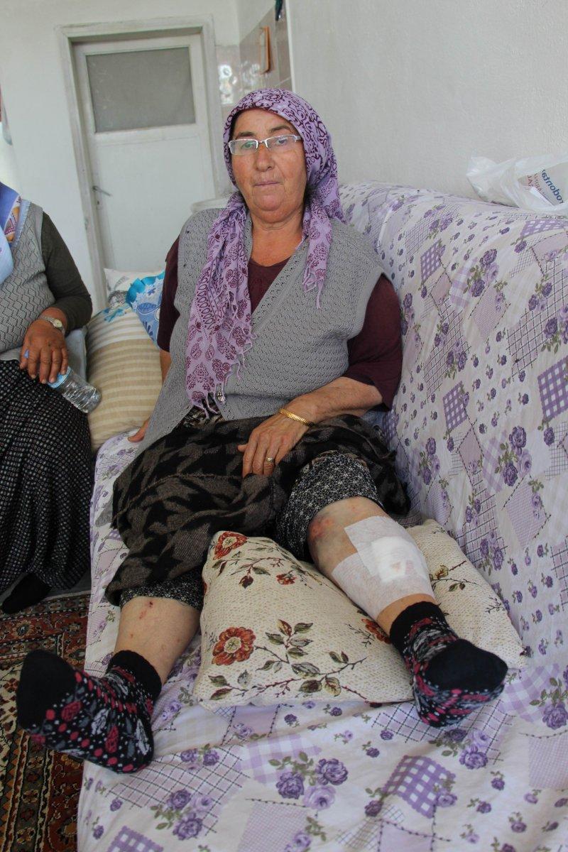 Nevşehir’de anne ve kızına tarlada köpek saldırdı