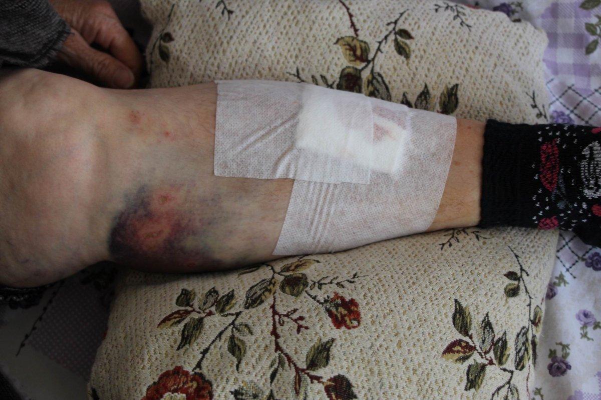 Nevşehir’de anne ve kızına tarlada köpek saldırdı