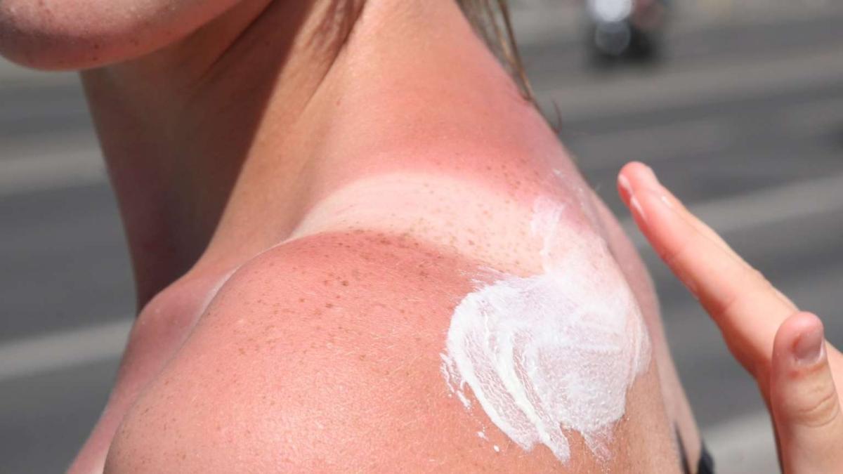 Güneşin yerden yansıyan ışınları da yakıyor