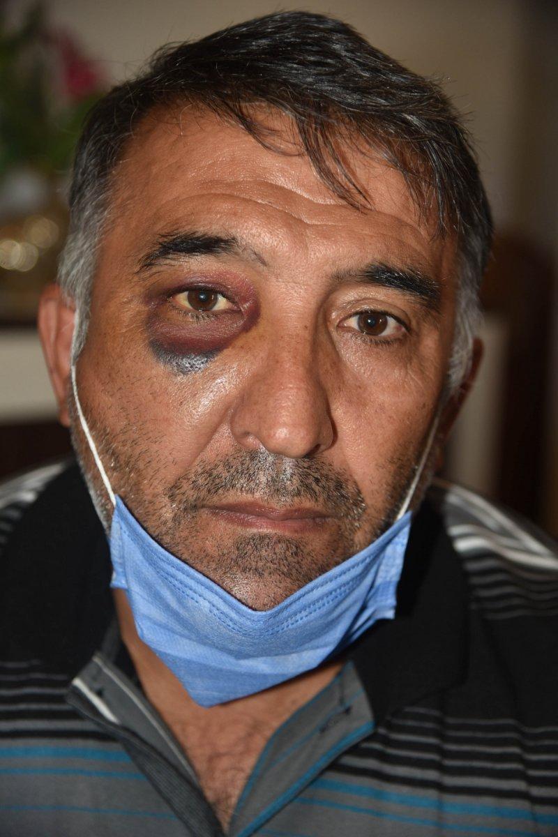 Antalya’da davada şahitlik yaptılar, şemsiye sopasıyla darbedildiler