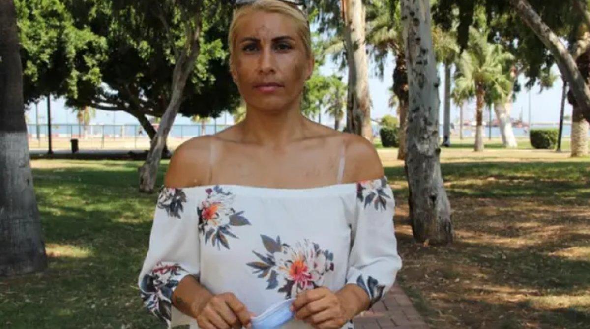 Mersin'de, yıllar önce ayrıldığı sevgilisi başına bela oldu