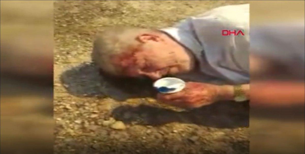 Antalya’da dumandan etkilenen Alman vatandaşını işçiler kurtardı