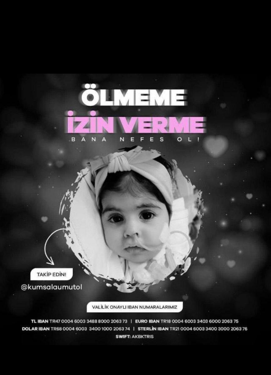 SMA hastası Kumsal bebek yardım eli bekliyor