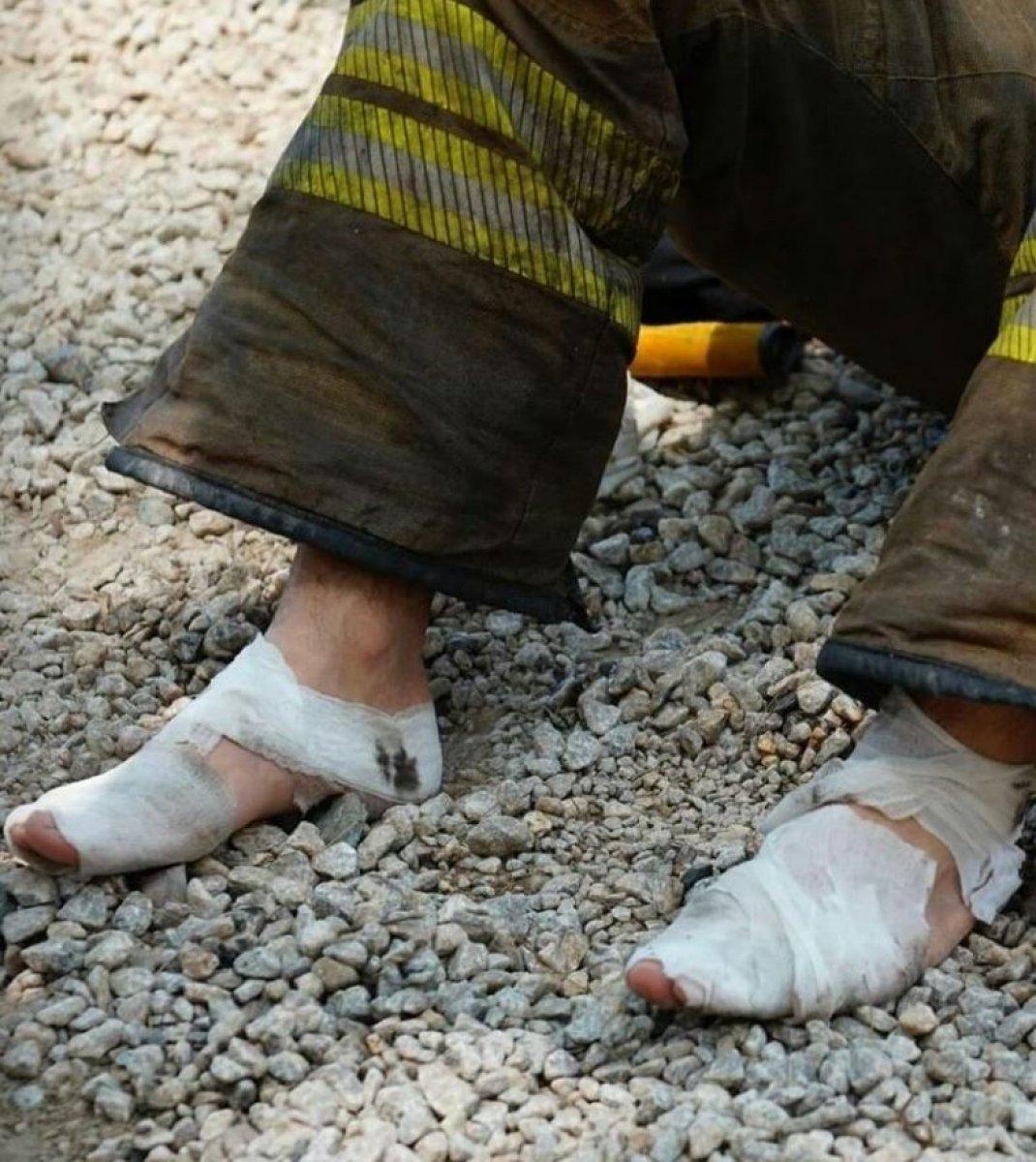 Ayakları sargı içinde olan personel, yangın bölgesinden ayrılmadı