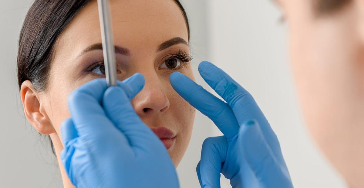 Burun estetiğinde ameliyat kişiye göre planlanmalı