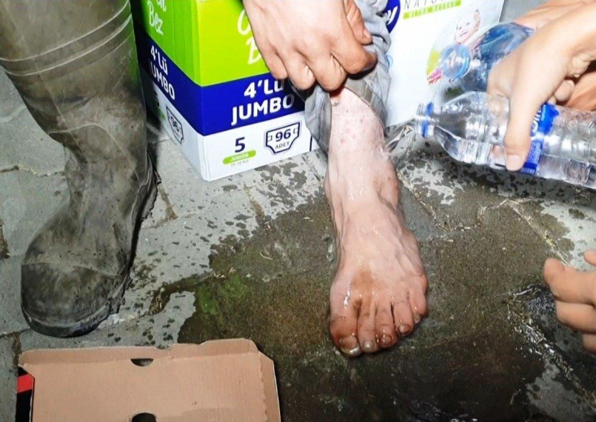 Aydın'da yanan ayağına aldırış etmedi, yangın söndürme çalışmalarına katıldı