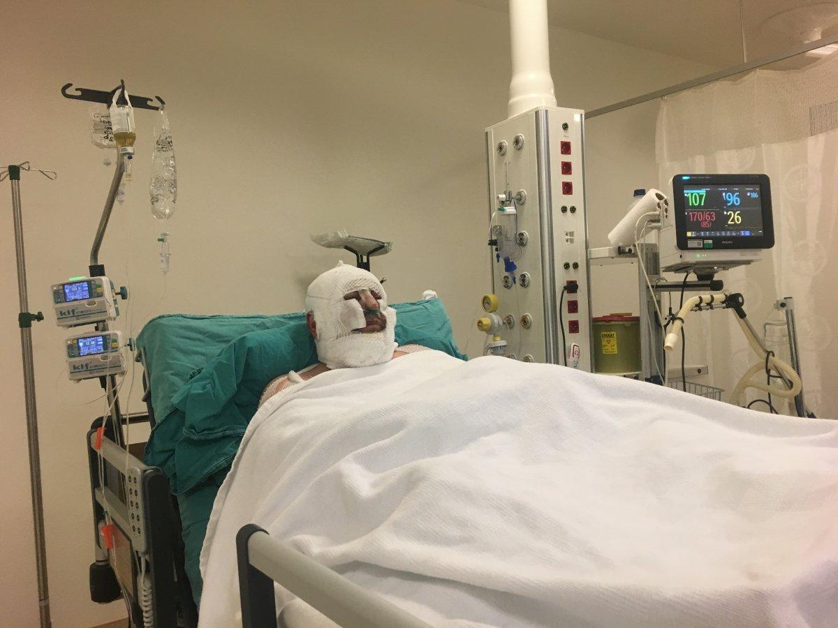 Denizli'de alevlerin arasında kalan kahraman ormancı o anları anlattı