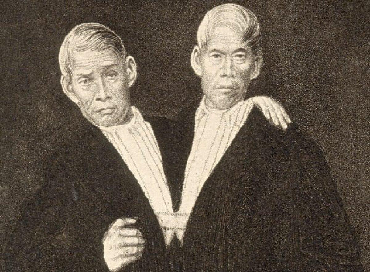 Tek bedende iki arzu: Siyam İkizleri Chang ve Eng Bunker’in hikayesi