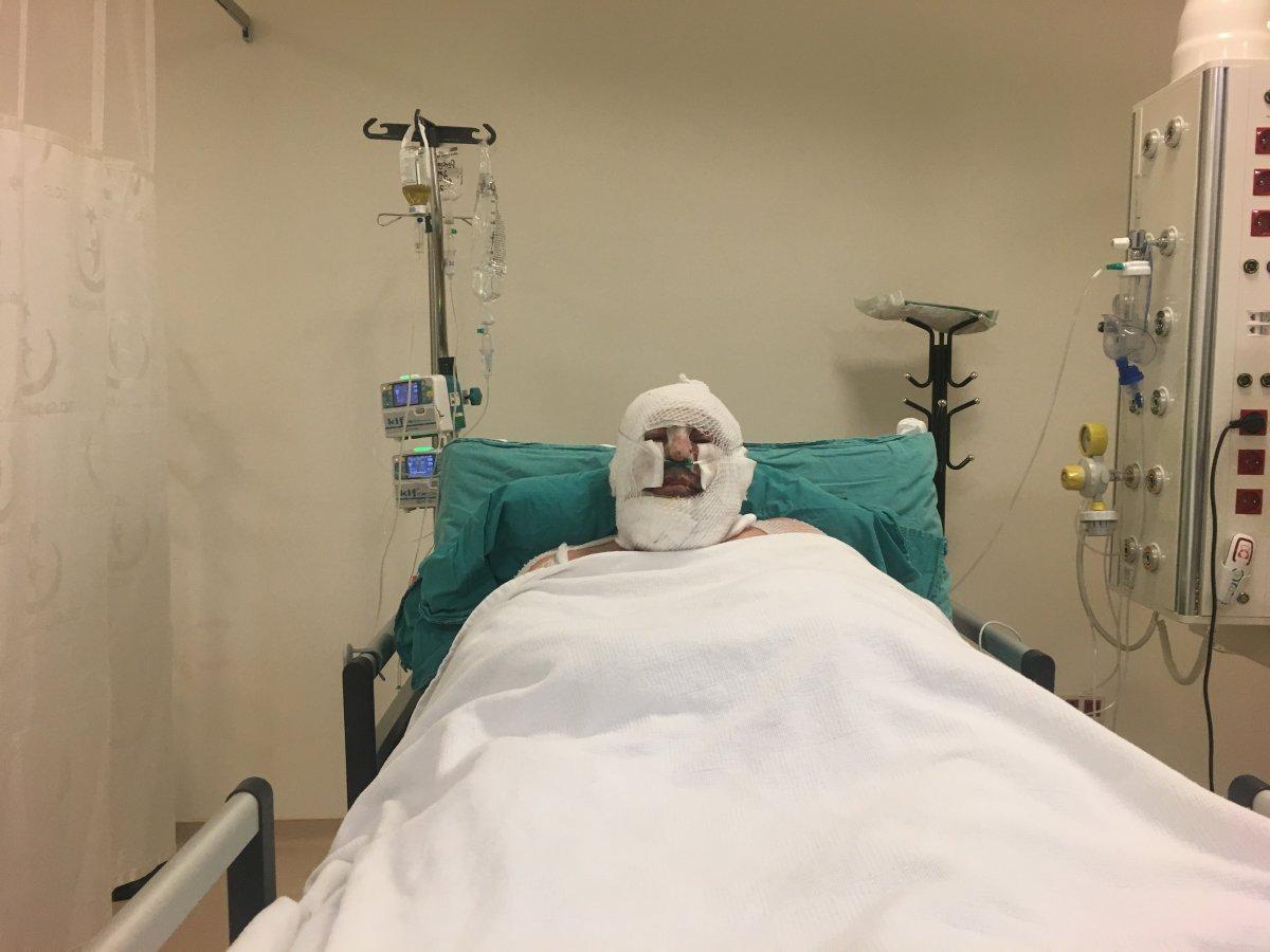 Denizli'de alevlerin arasında kalan kahraman ormancı o anları anlattı