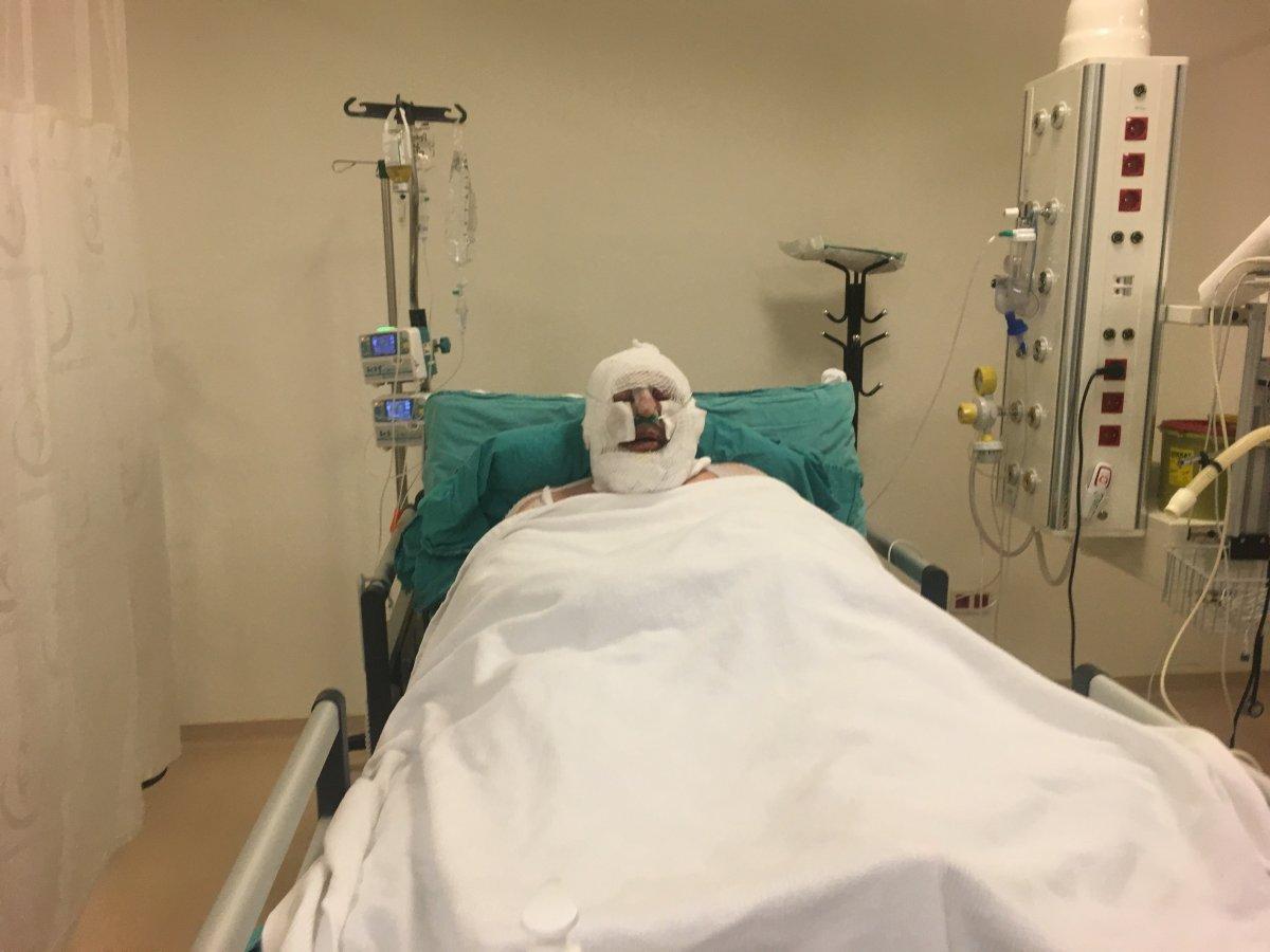 Denizli'de alevlerin arasında kalan kahraman ormancı o anları anlattı