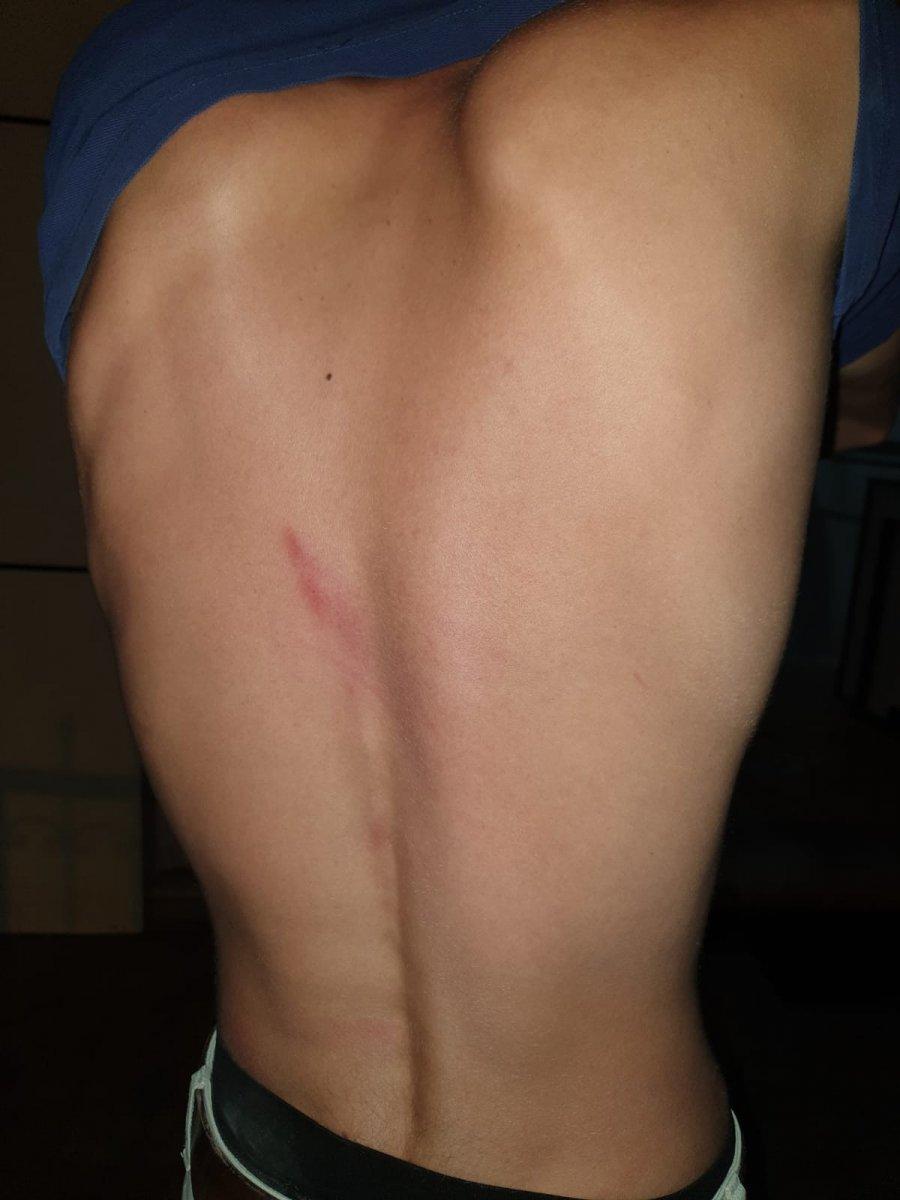 Beylikdüzü'nde aracıyla çarptığı motosikletliyi darbetti