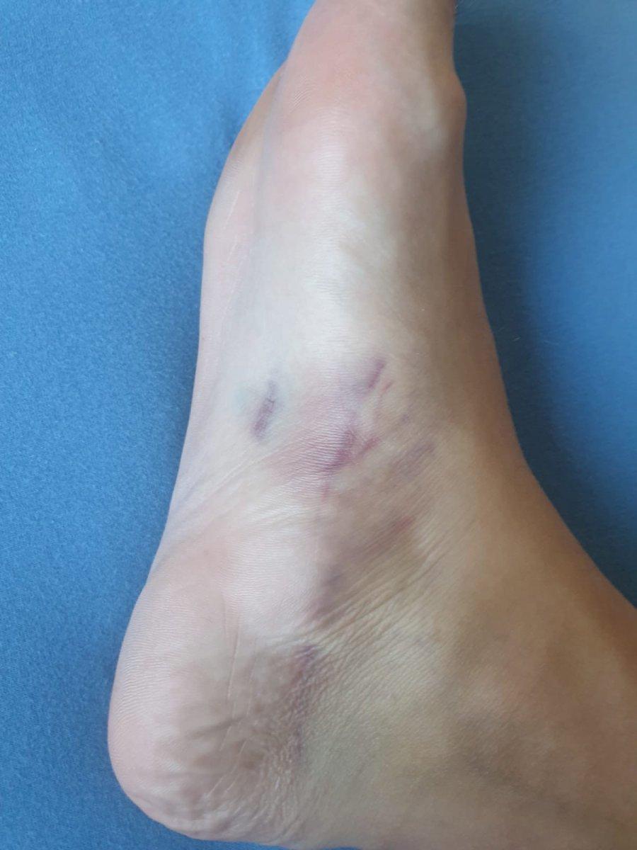 Beylikdüzü'nde aracıyla çarptığı motosikletliyi darbetti