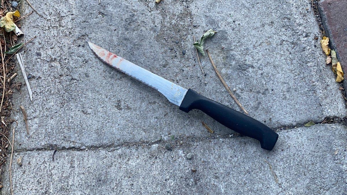 İstanbul'da tartıştığı sevgilisi tarafından bıçaklandı