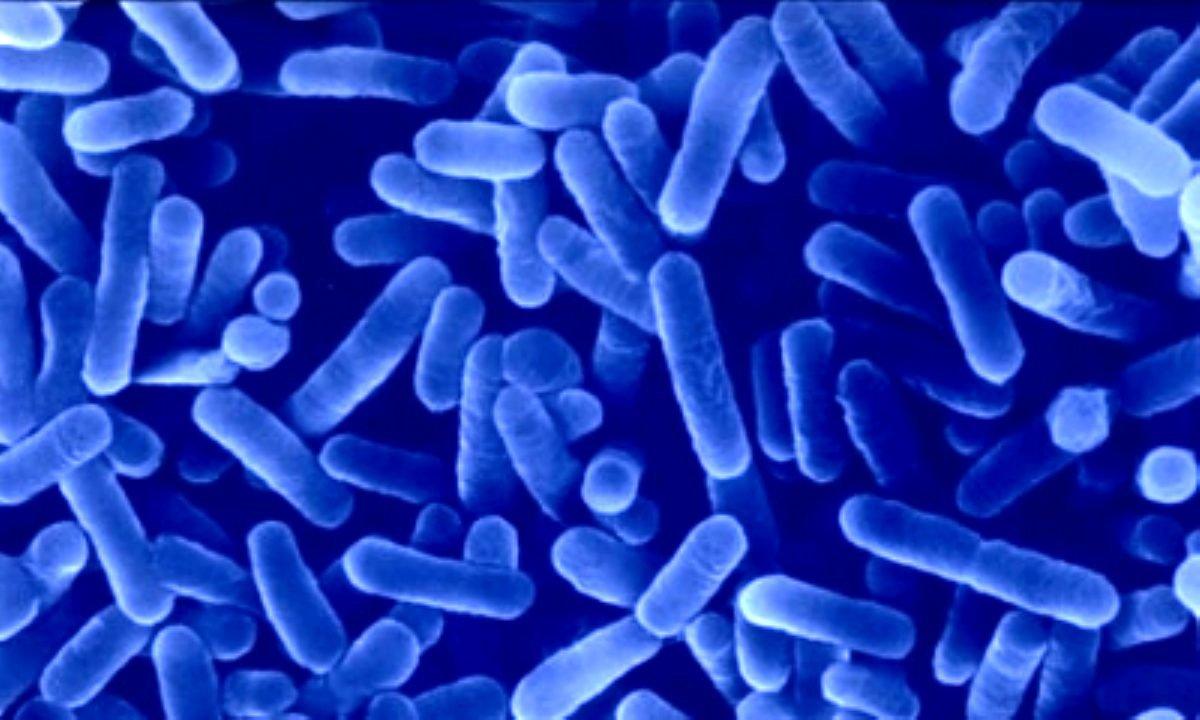 Klimalardan yayılıyor: Lejyoner hastalığı nedir, belirtileri nelerdir?