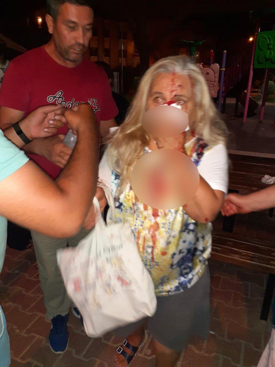 Antalya’da bir kadın, 2 pitbull köpeğinin saldırısına uğradı