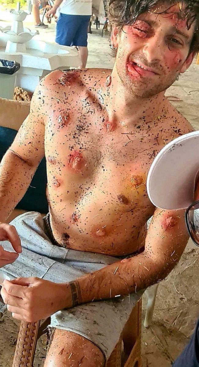 Bora Akkaş'ın set hali