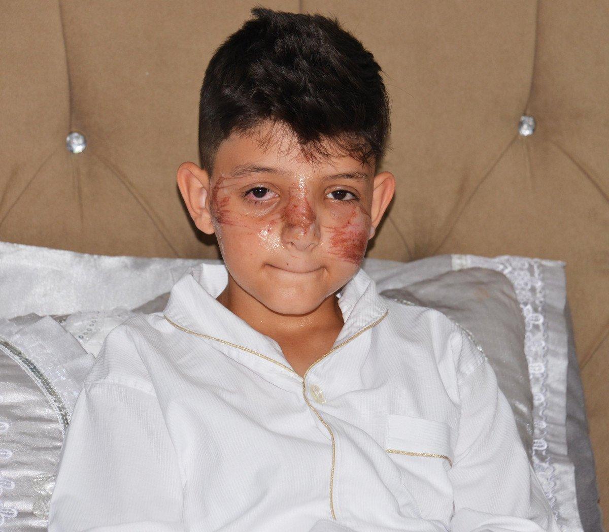 Erzurum’da çocuklar, bahşiş almak isterken ölüme neden oluyordu