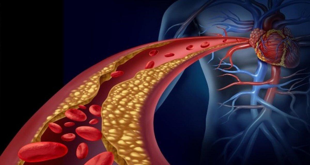 K vitamini, damar tıkanıklığını önlüyor