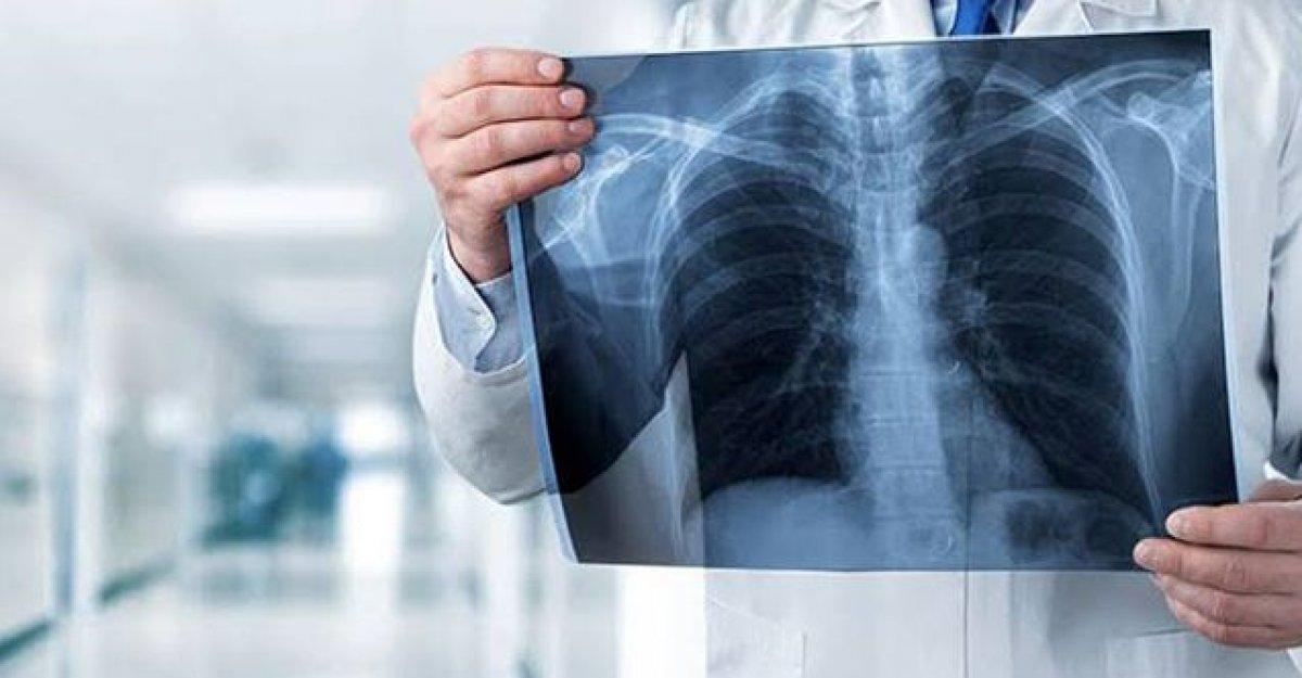 Delta varyantından sonra en uzun süren 5 belirti