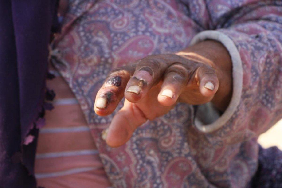 Manavgat'taki yangında alevlerin arasında kaldılar