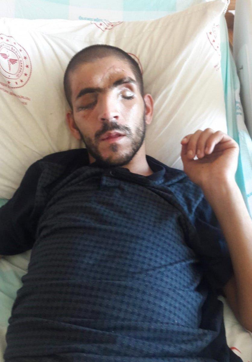 Balıkesir’de kaza geçiren baba sadece kızı görmek istiyor