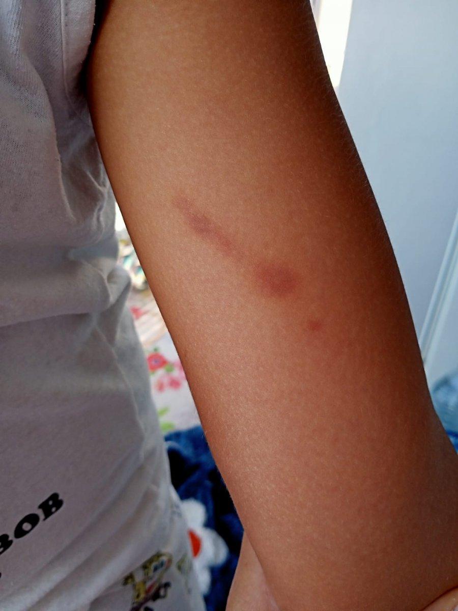 Bursa’da boşandığı eski eşi, oğlunu darbetti