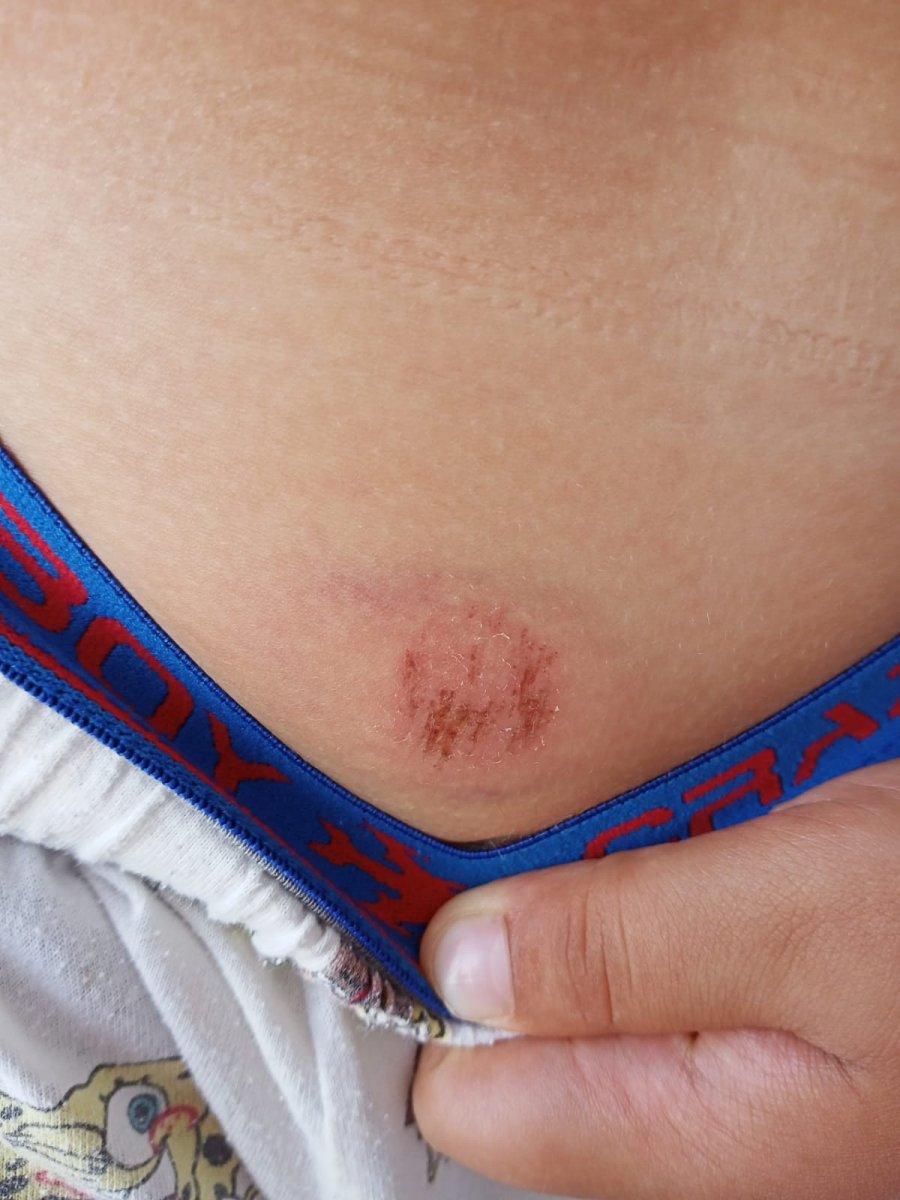 Bursa’da boşandığı eski eşi, oğlunu darbetti