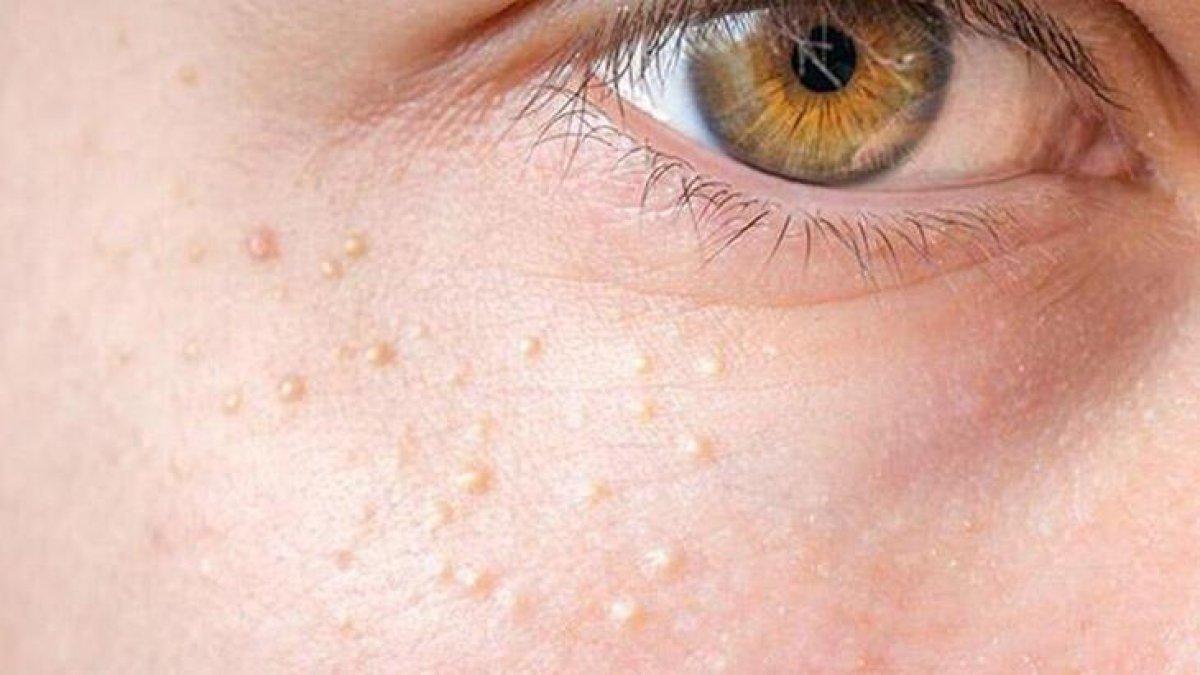 Kalbinizin tehlikede olduğunu gösteren 7 işaret