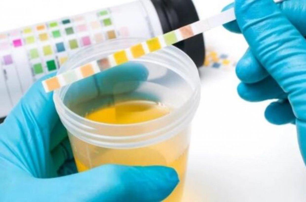 Hayatınızı kurtarabilecek çok basit 6 sağlık muayenesi