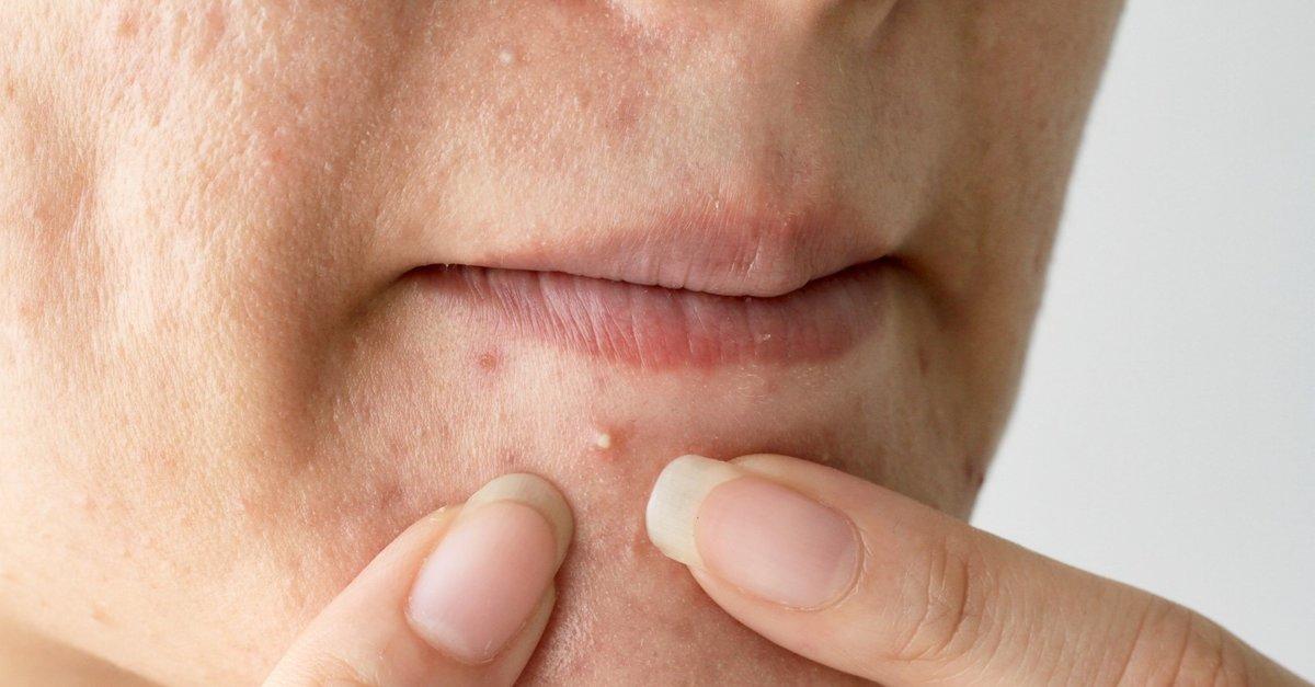 Hayatınızı kurtarabilecek çok basit 6 sağlık muayenesi