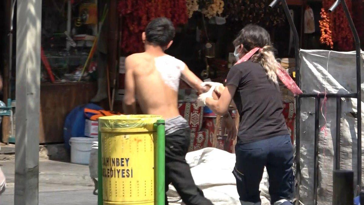 Gaziantep'te üzerine sıcak çay dökülen çocuk ambulanstan kaçtı