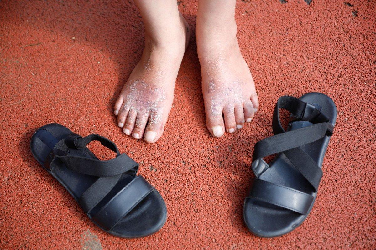 Küçükçekmece’de 30 liraya aldığı ayakkabı, sağlığından etti