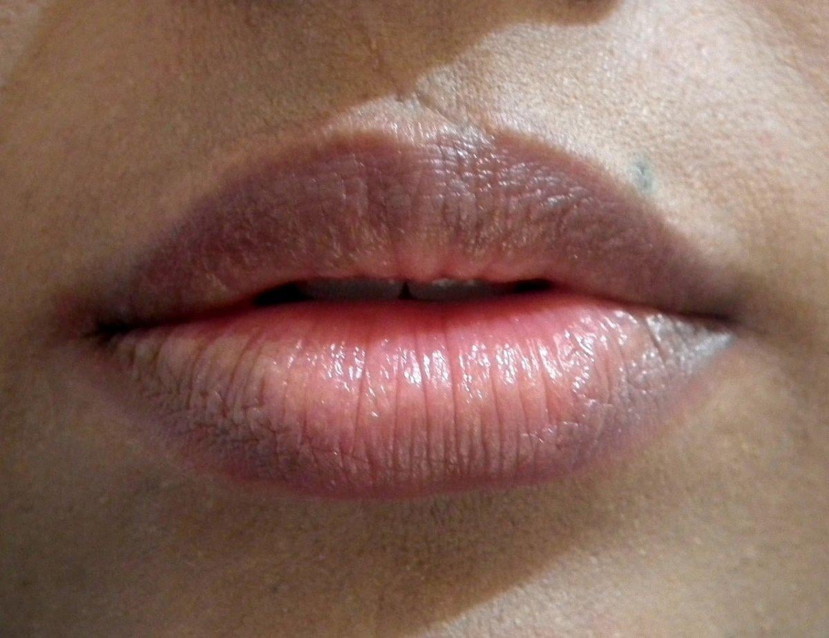 Dudaklardaki renk değişiklikleri hastalık habercisi olabilir