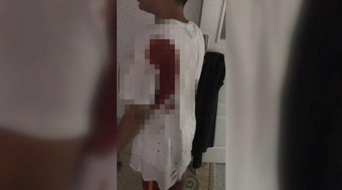 Sultangazi’de oyun oynayan çocuk, yorgun mermiyle vuruldu