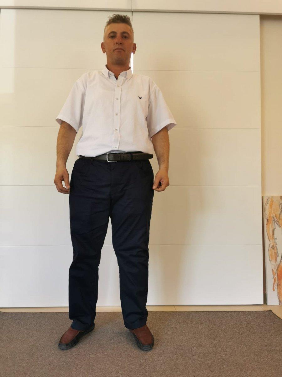 Ispartalı Hakan’ın bedeninden tam 35 kiloluk kitle çıktı