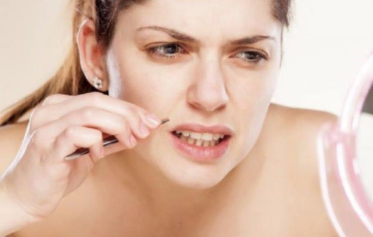 Aşırı tüylenme ile kendini gösteren hastalıklar